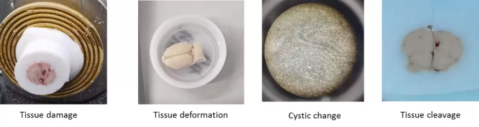 Figure 1: Examples of abnormal tissue outcomes